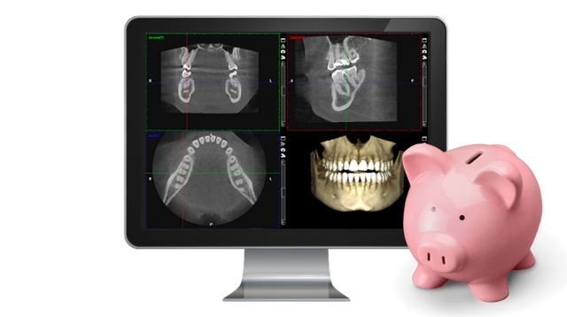 3D Cbct Scan Price Tech Review & Benchmarks 2026